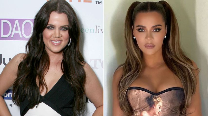 Findet sich "wunderschön": Khloé Kardashian trotzt OP-Kritik