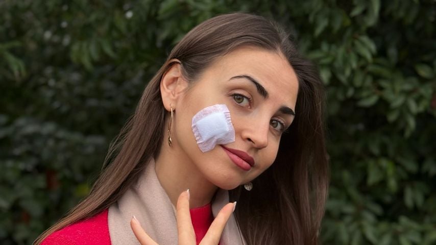 Ekat Leonova musste Muttermal im Gesicht entfernen lassen