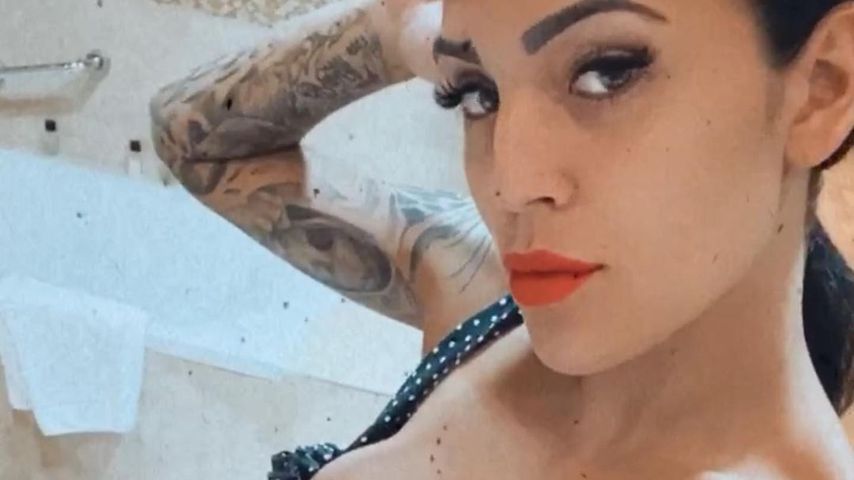 Nach zweiter Brust-OP: Elena Miras' Narbe hat sich entzündet