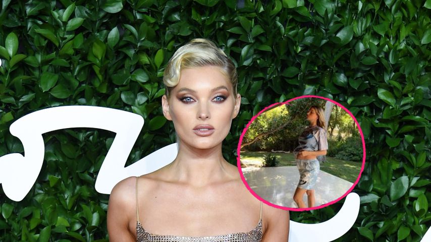 Es wird ernst: Schwangere Elsa Hosk zeigt XXL-Babybauch