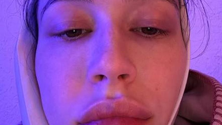 Elsie Hewitt nach der Zahn-OP, Dezember 2025