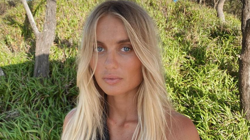 Elyse Knowles muss sich ausruhen: Ihr Baby ist in Steißlage