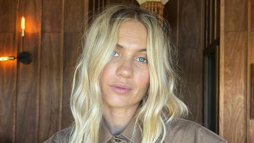 Windpocken-Eklat: Elyse Knowles zeigt Tochter ohne Kleidung