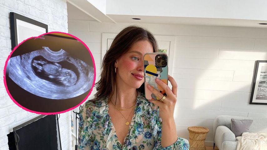 Mit Ultraschallbild: Model Emily DiDonato wird erneut Mama