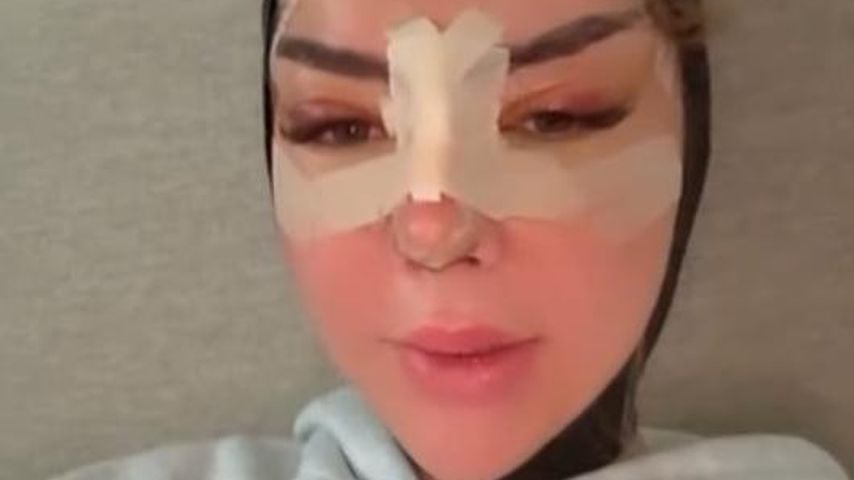 Emma Fernlund wenige Tage nach ihrer Gesichts-OP, November 2025