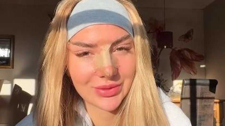 Emma Fernlund bewirbt Beauty-OP: Fans finden es "fahrlässig"