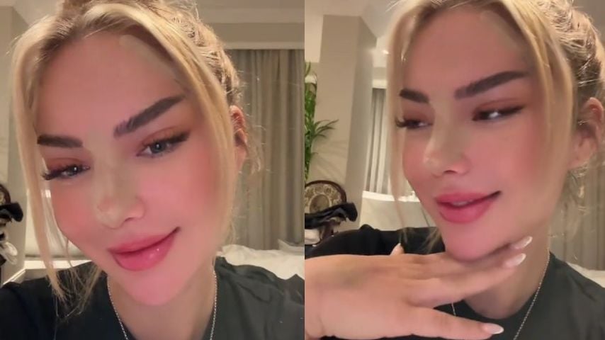 Völlig anders: Emma Fernlund zeigt nach OP ihr neues Gesicht