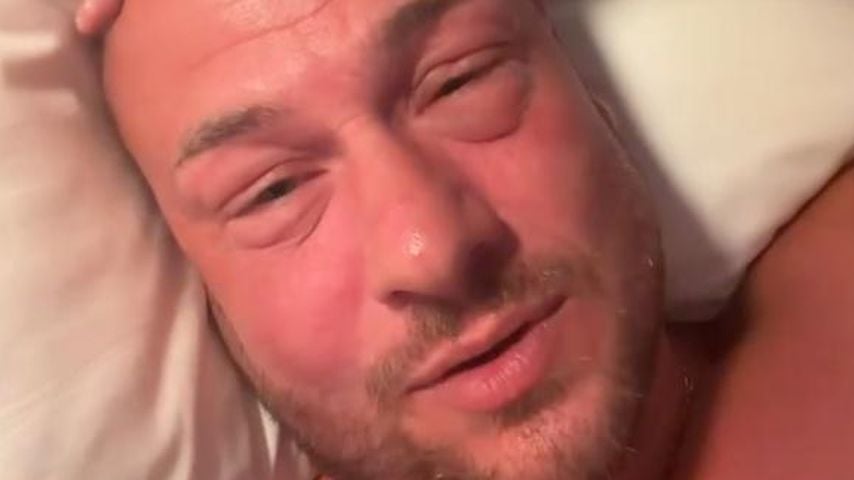 Eric Sindermann mit geschwollenem Gesicht, Juli 2026