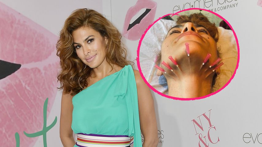 Beauty-Behandlung? Eva Mendes schockiert mit Spritzenfoto!