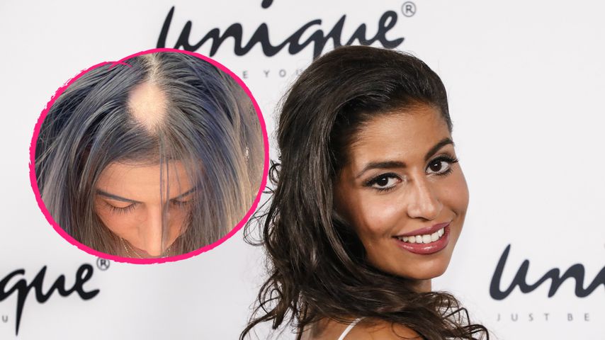 Bachelor-Star Eva Benetatou offen: Sie leidet an Haarausfall