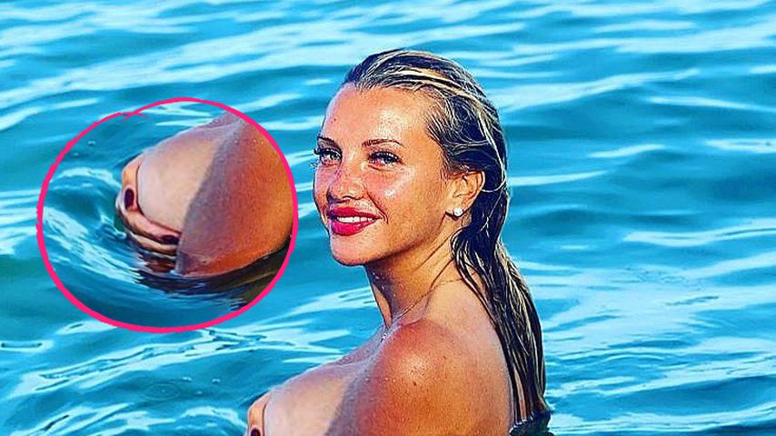 Verzerrte Hand am Busen: Photoshop-Panne bei Evelyn Burdecki