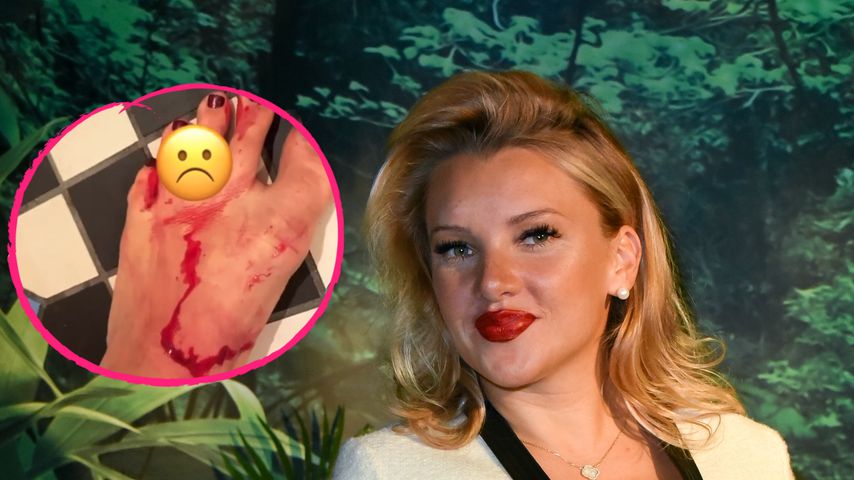 Blutender Fuß: So schlimm hat sich Evelyn Burdecki verletzt