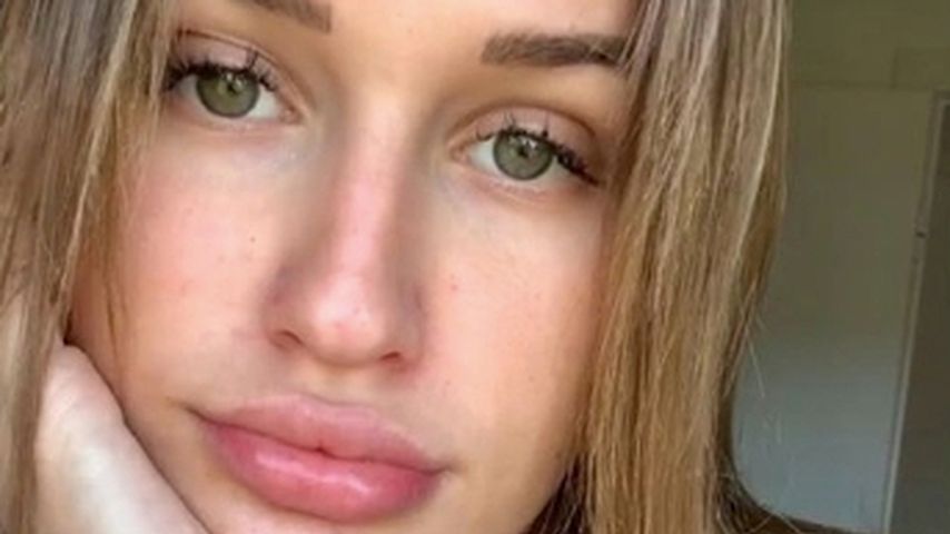 Ex-GNTM-Kandidatin Neele Bronst