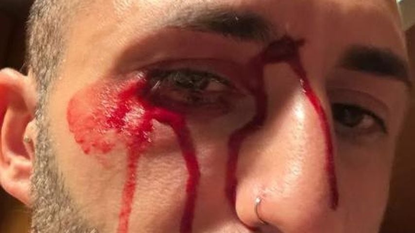 Fabio De Pasquales blutiges Gesicht, Januar 2026