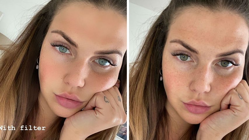 Novalanalove kritisiert: Manche Insta-Filter gehen zu weit