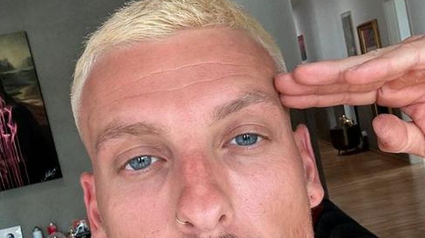 Top oder Flop? Felix Lobrecht färbt seine Haare knallblond!