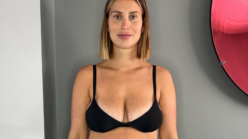 Ehrliches Bild: Ferne McCann macht Frauen nach Geburt Mut!