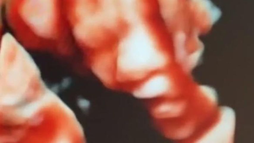 Fiona Erdmanns Baby in 3D