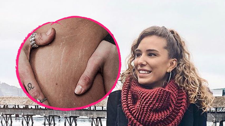 Anja Zeidler superoffen: Sie zeigt ihre Dehnungsstreifen!