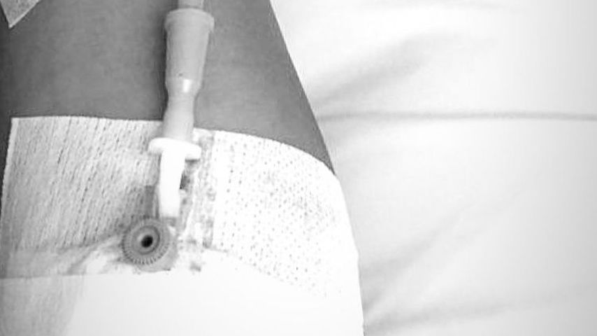 Foto von Kevin Yaniks angeblichem Krankenhausaufenthalt