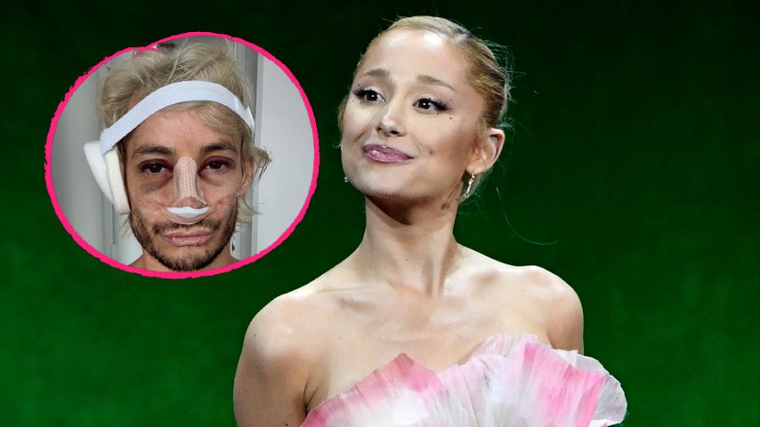 Süß! Ariana Grande unterstützt Bruder Frankie nach Nasen-OP