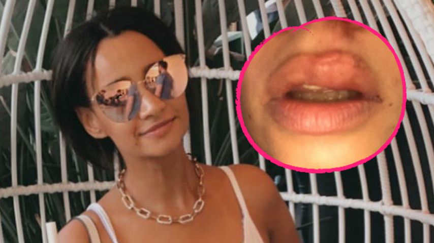 Ex-Queensberry Gabby riskiert beim Skaten eine dicke Lippe