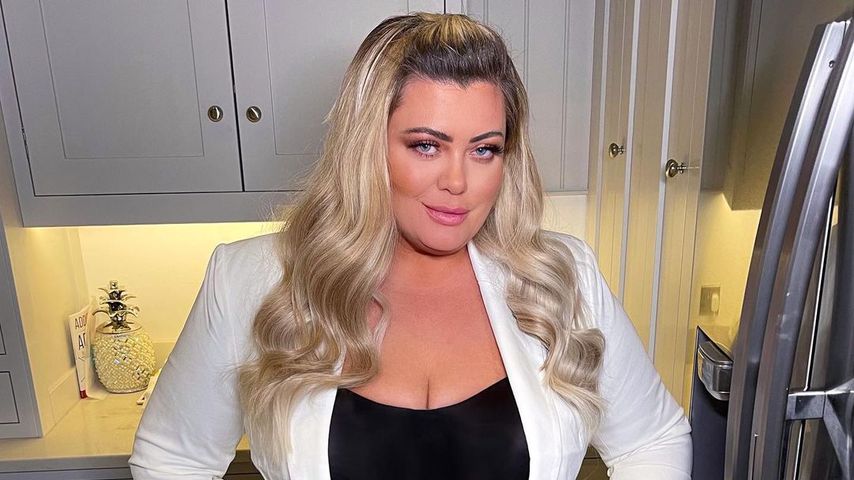 Gemma Collins ließ sich Botox und alle Filler entfernen