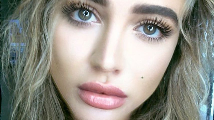 UK-"Love Island"-Georgia wegen geplatzter Zyste in Klinik