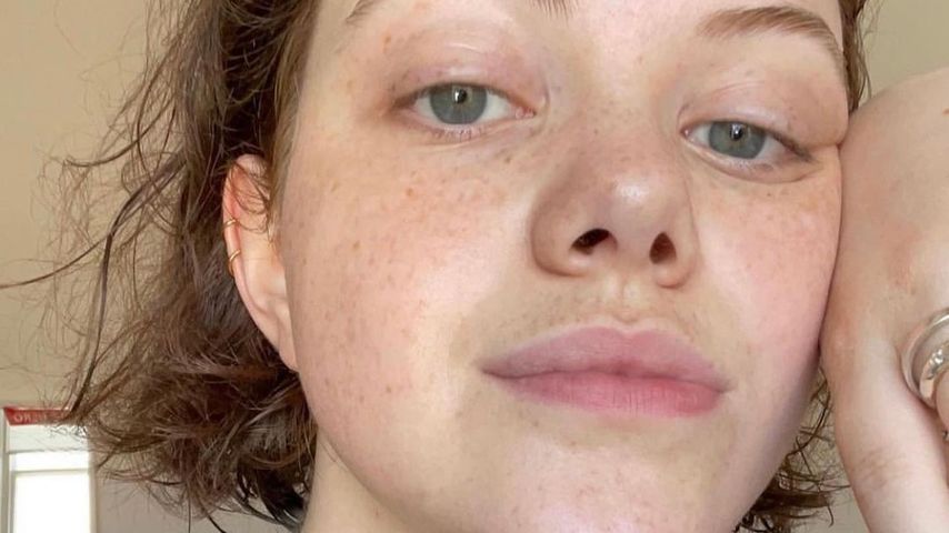Gefährliche Infektion: Georgie Henley kämpfte um ihr Leben!