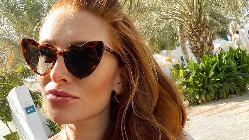 Wegen Blessuren: Georgina Fleur traut sich kaum noch raus