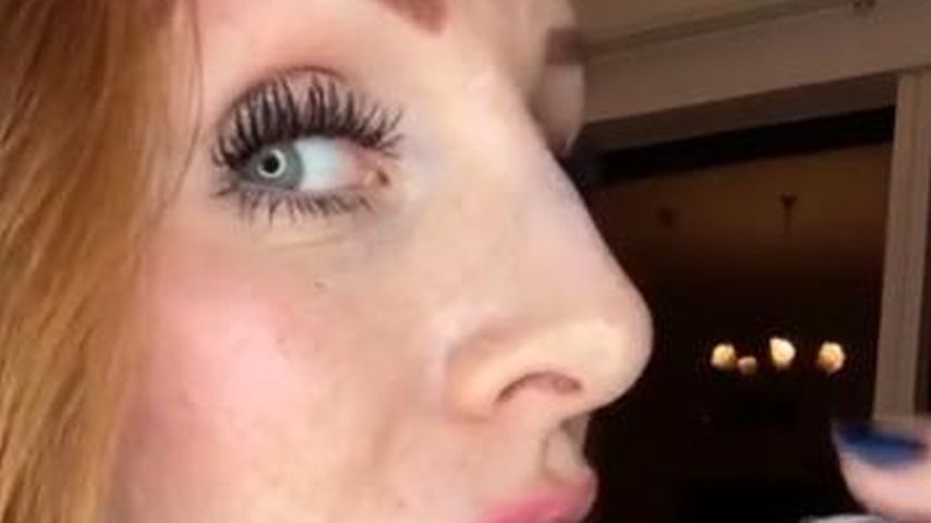 Hyaluron-Panne: Georgina Fleur mega-unzufrieden mit Nase!