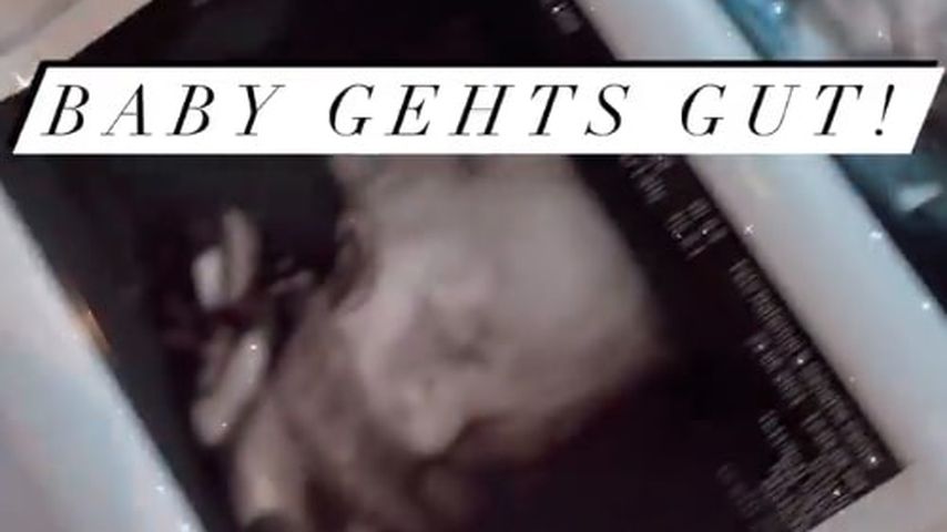 Ultraschallbilder, die das Baby von Reality-TV-Star Georgina Fleur zeigen