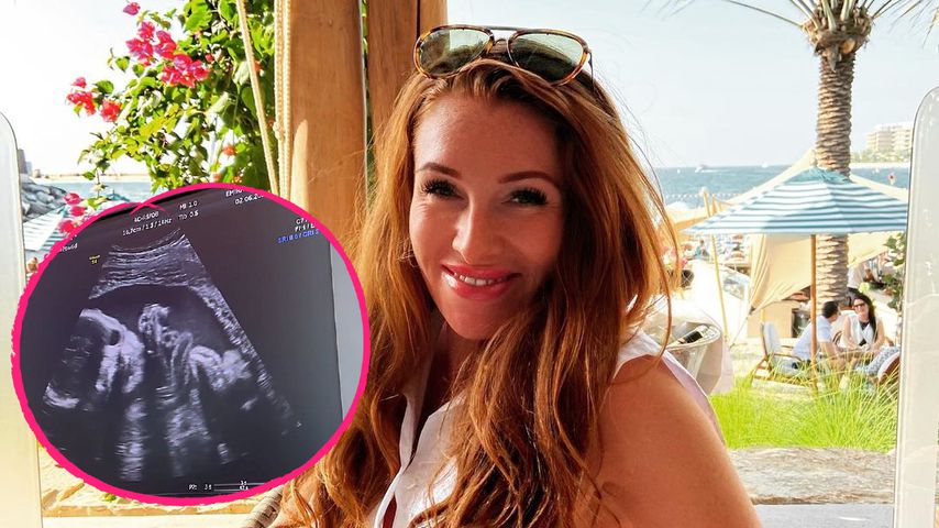 "Wie süß!": Georgina jubelt über Ultraschallbild ihres Babys
