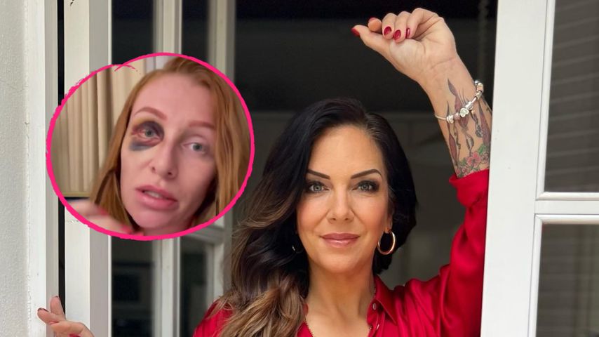 Georgina mit Veilchen: Freundin Danni Büchner leidet mit ihr