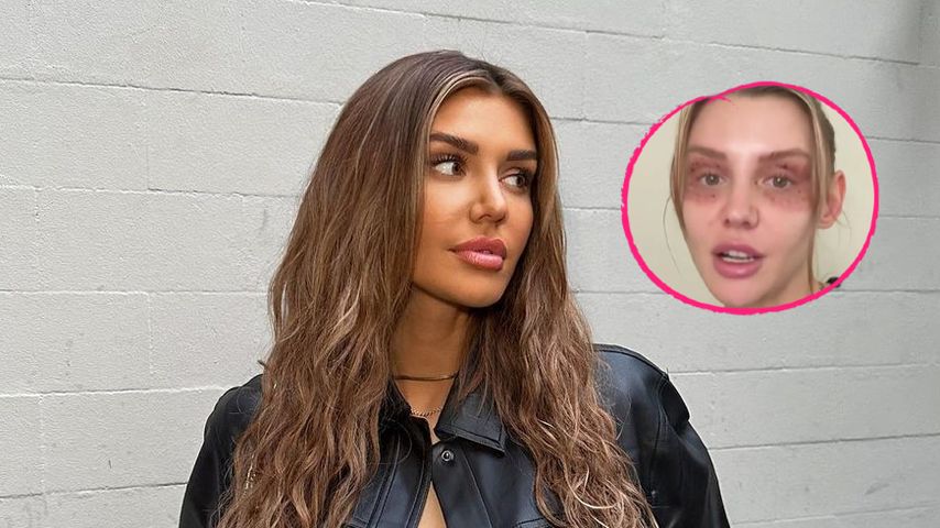 Wegen Beauty-Behandlung: Gerda Lewis sagt alle Termine ab