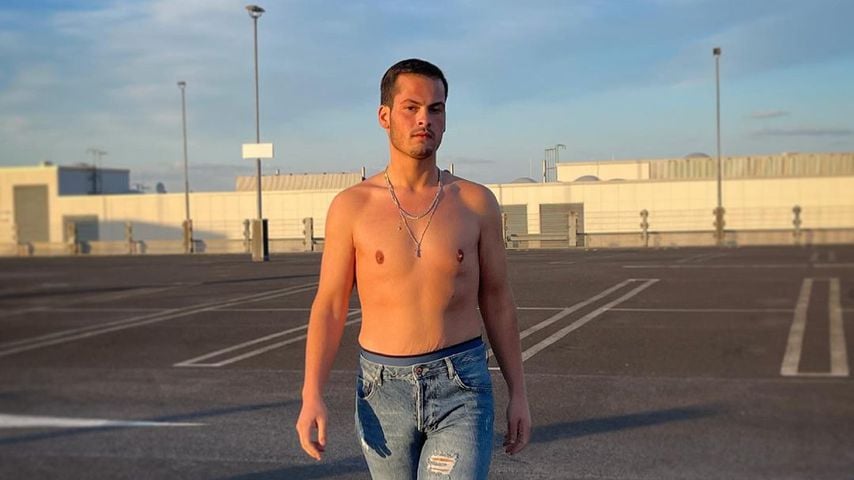 Nach "Biggest Loser": Lässt sich Gianluca Haut entfernen?