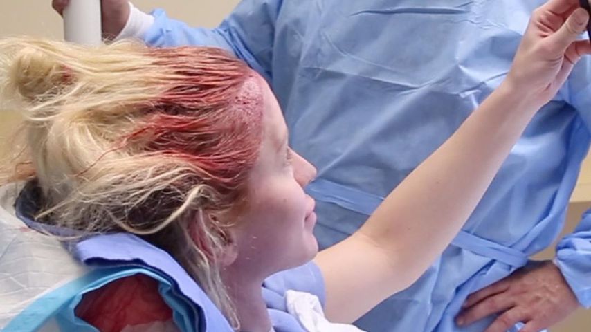 Gigi Gorgeous bei ihrer Haartransplantation