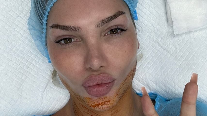 Giuliana Farfalla lässt sich "kleines Doppelkinn" absaugen