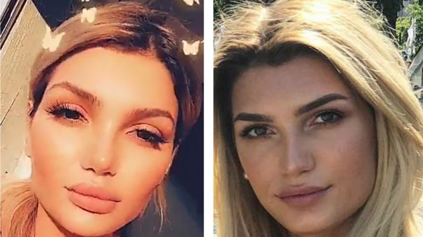 Tatsächlich: GNTM-Giuliana Farfalla hatte eine Nasen-OP