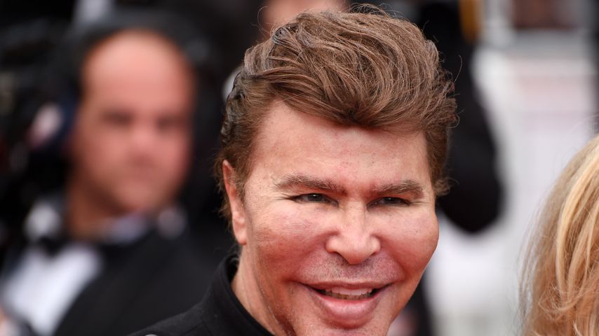Botox-Zwilling Grichka Bogdanoff mit 72 Jahren gestorben
