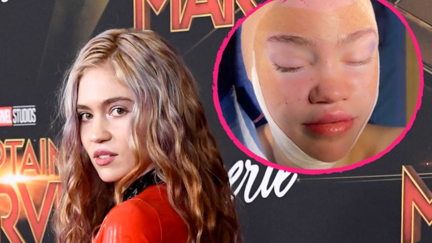 "Etwas Verrücktes": Was steckt hinter Grimes' Kopfverband?