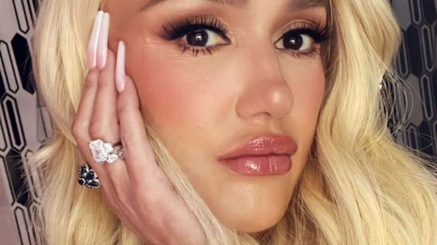 Fans fragen sich: Hat Gwen Stefani sich die Lippen gemacht?
