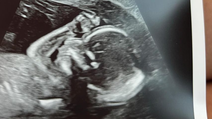 Gypsy Rose Blanchards Ultraschallbild im September 2024