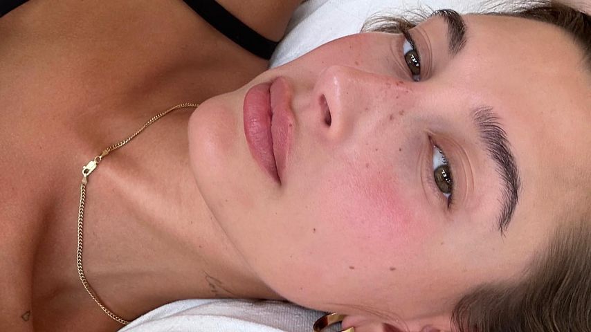 Ungefiltert und echt: Schnappschüsse der Stars ohne Make-up
