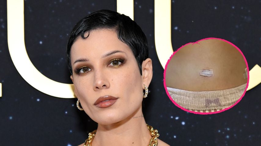 Weitere Endometriose-OP: Halsey zeigt sich in einer Windel