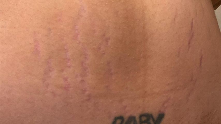 Halseys Bauch