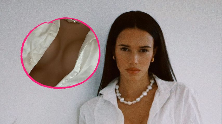Nach Beauty-OP: Hanna Schlönvoigt zeigt ihre neuen Brüste