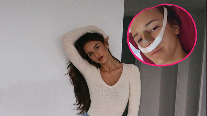 Brust und Nase operiert: Hanna Schlönvoigt gibt Update