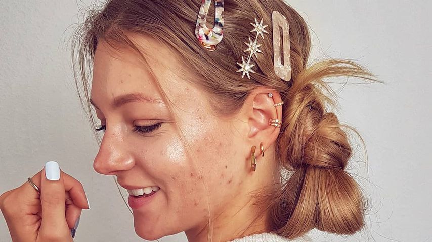 Hanna Bohnekamp, ehemalige GNTM-Kandidatin
