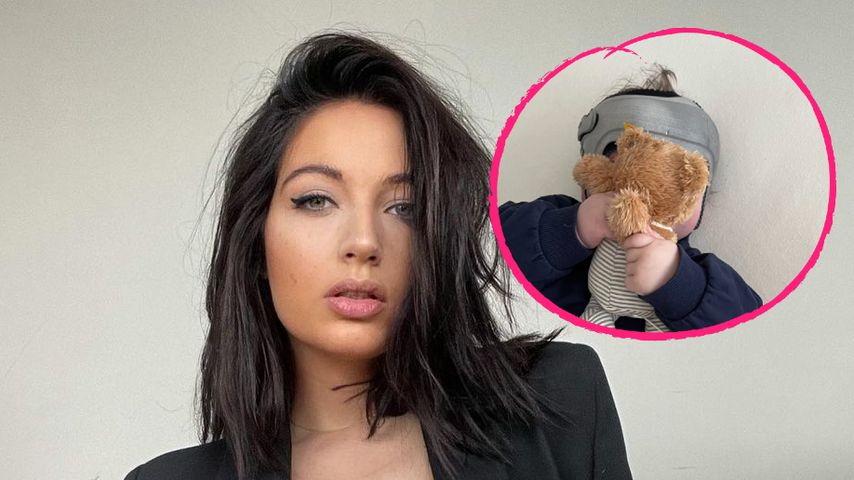 Kopfverformung: Hannah Kerschbaumers Sohn braucht Therapie